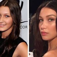  Bella Hadid, dovada ca operatiile estetice iti pot garanta succesul profesional